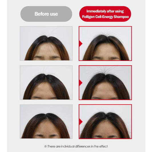 DRFORHAIR Folligen Cell-Energy Shampoo 100ml