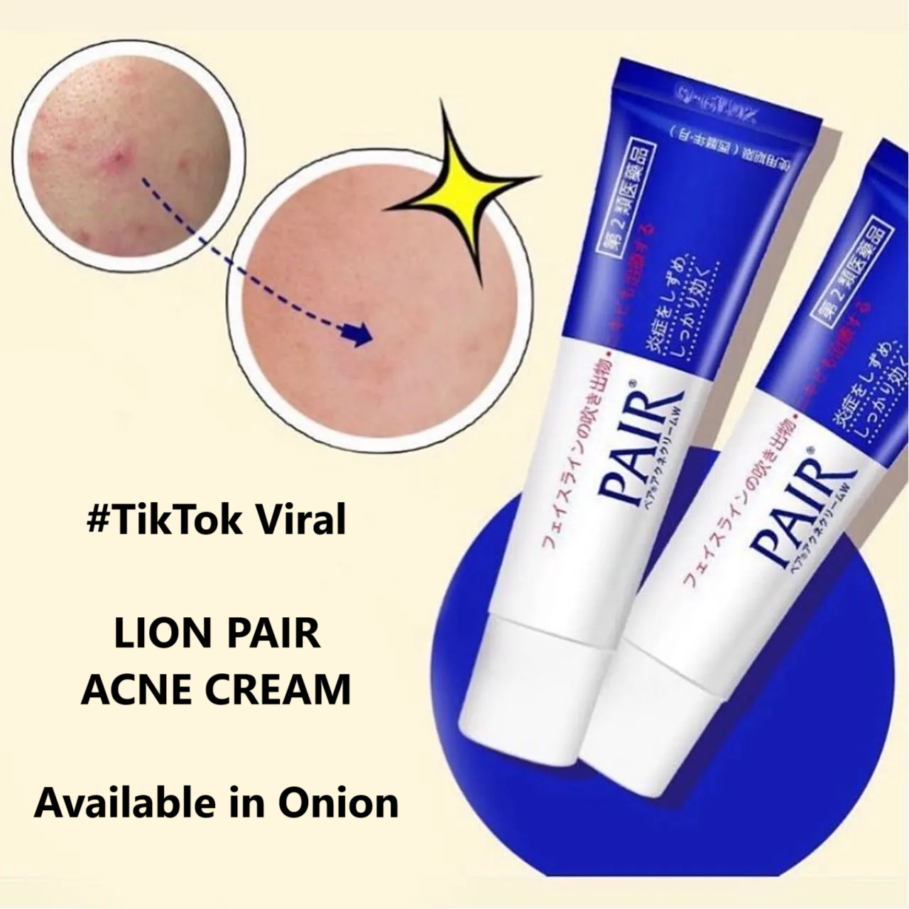 LION Pair Acne Cream 24g