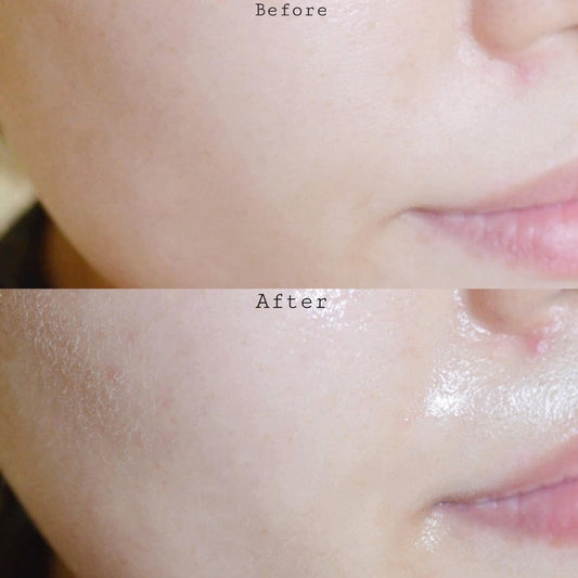 ISNTREE Hyaluronic Acid Water Mist 100ml