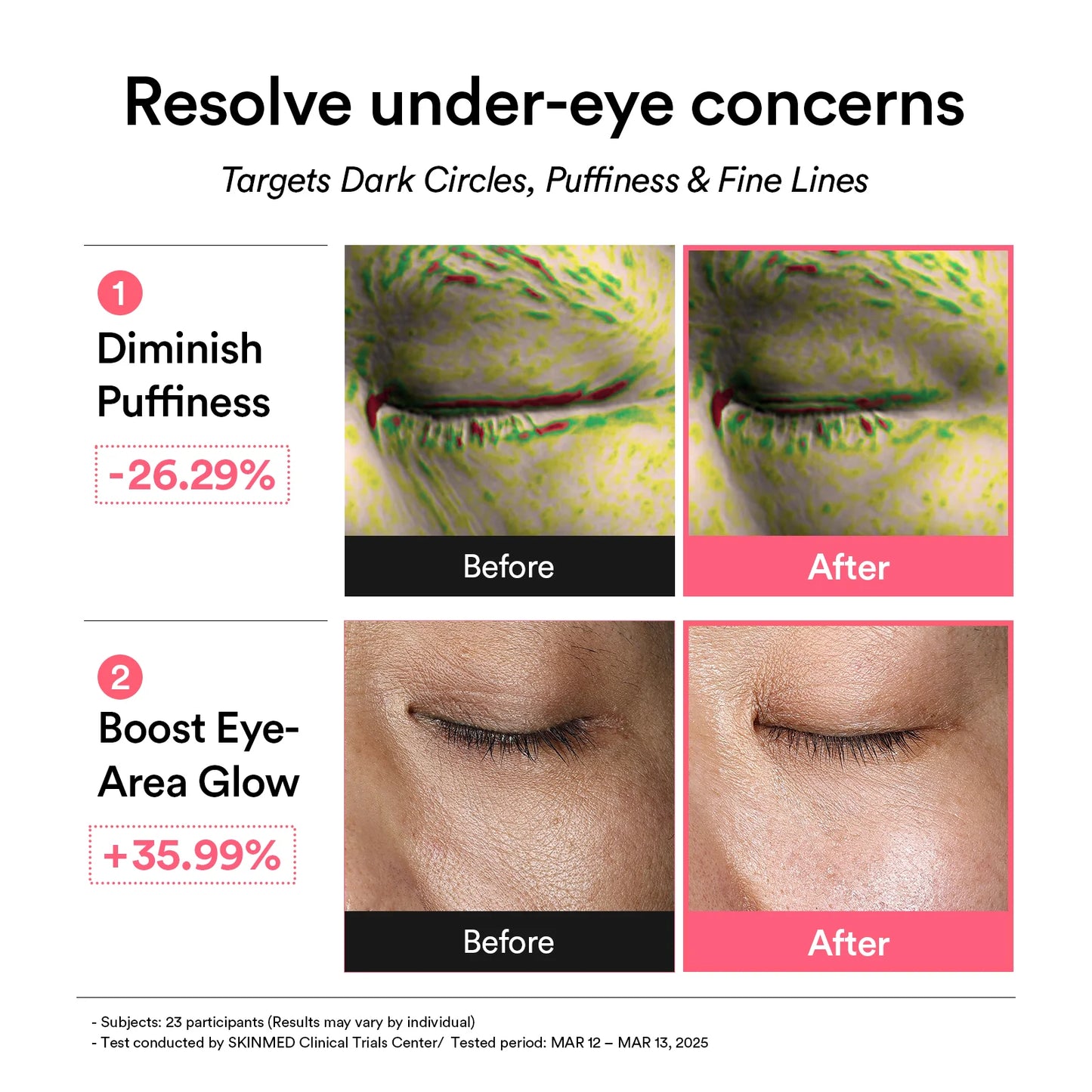 ABIB PDRN Retinal Eye Patch Glow Jelly 84g