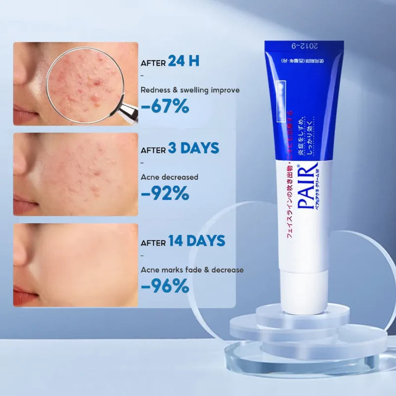 LION Pair Acne Cream 24g