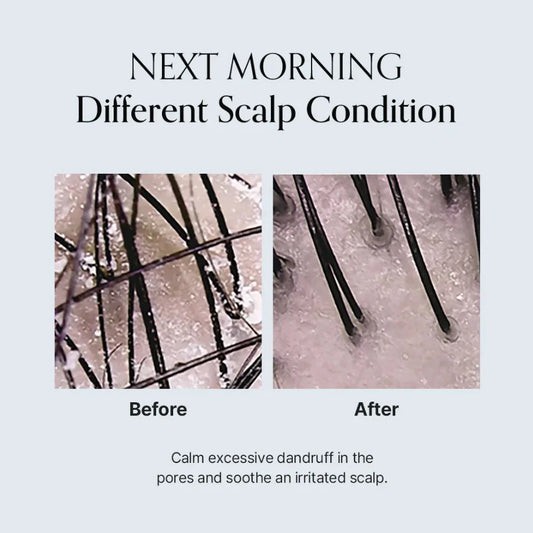 GROWUS Damage Therapy Scalp Scaling Ampoule 30ml