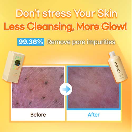HYAAH Mild But Deep Cleansing Water 300ml