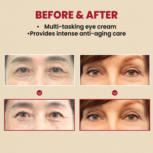 KSECRET Seoul 1988 Eye Cream : Retinal Liposome 4% + Fermented Bean