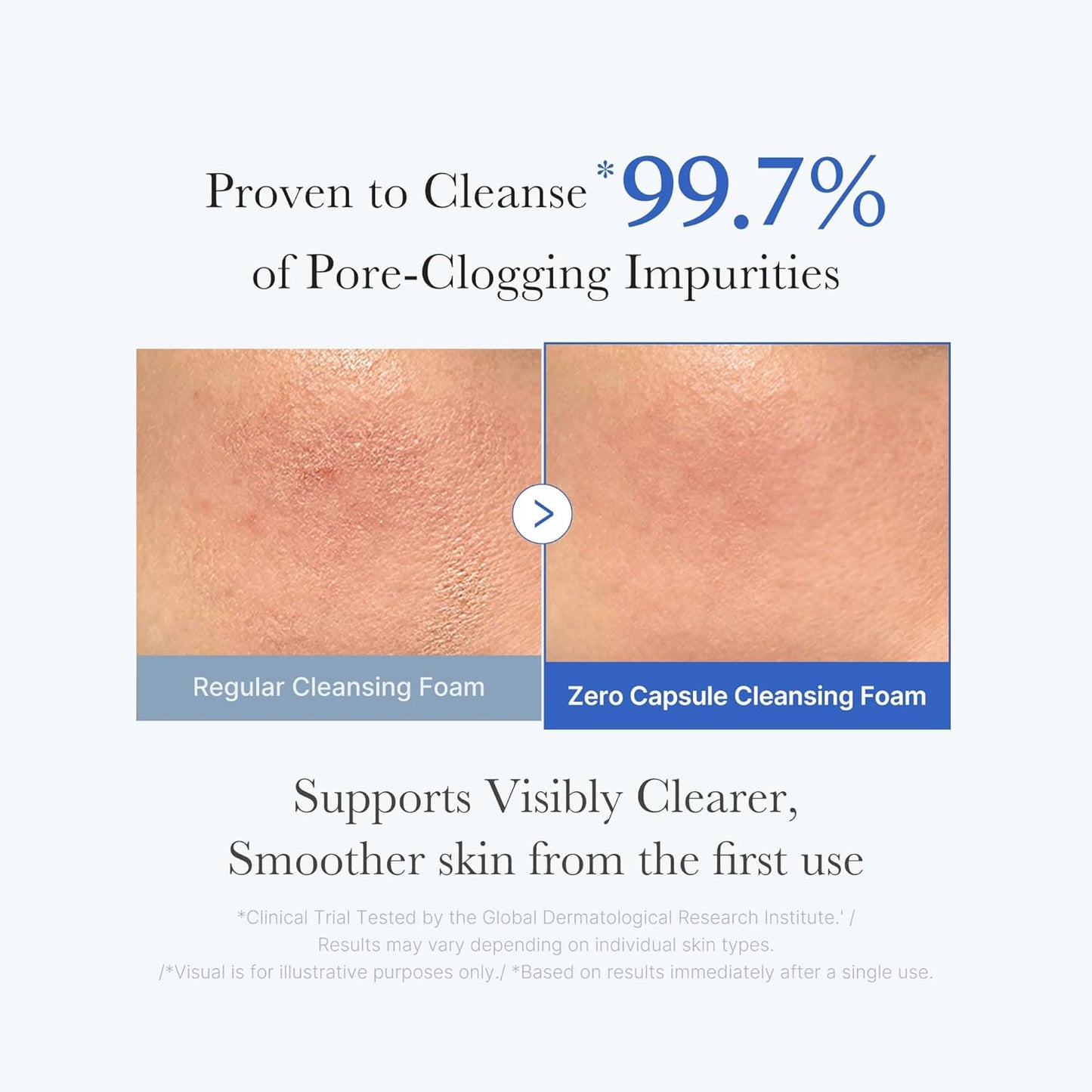 MEDICUBE Zero Pore Clearing Capsule Cleansing Foam 120g
