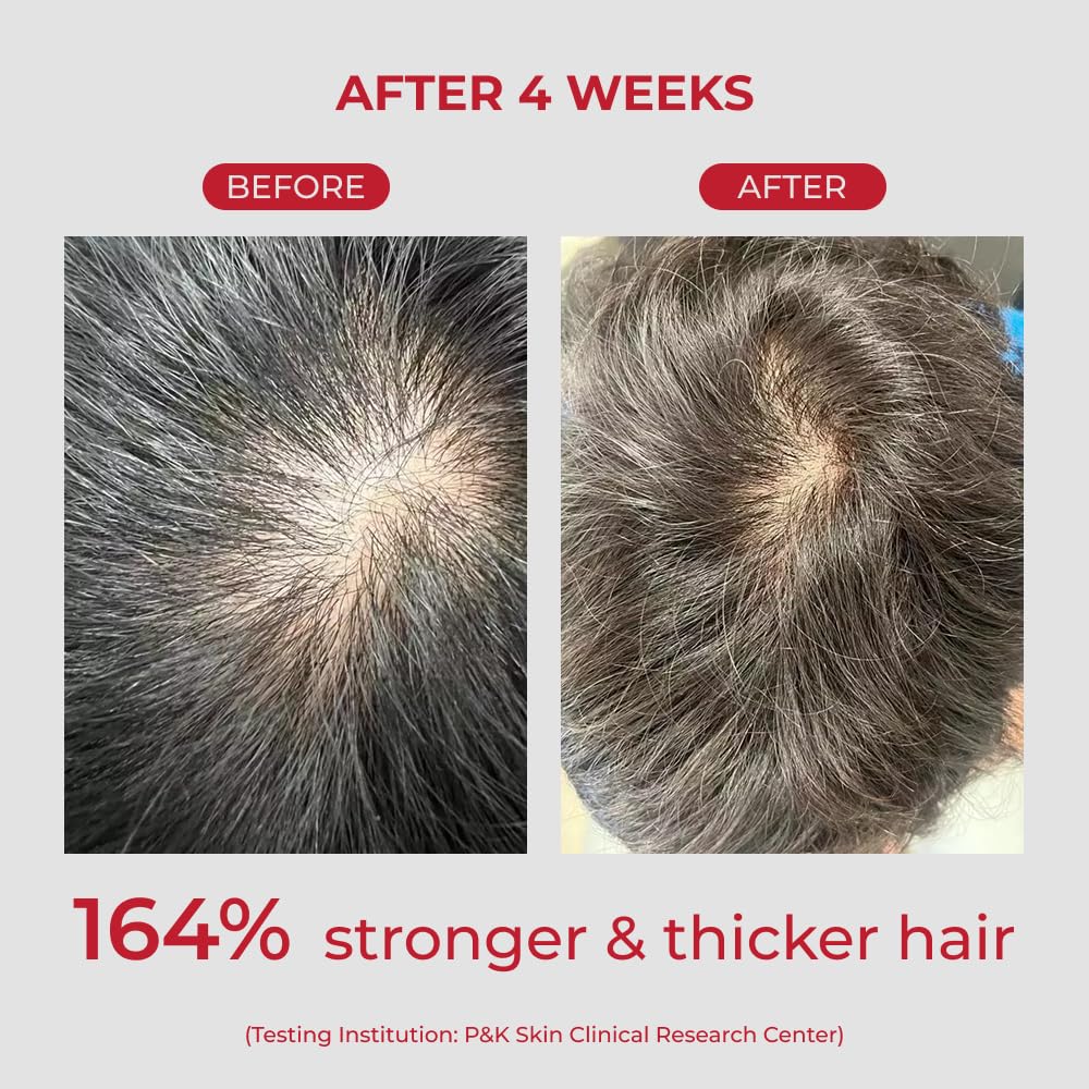 MOEV Annurcatin Shampoo 300ml