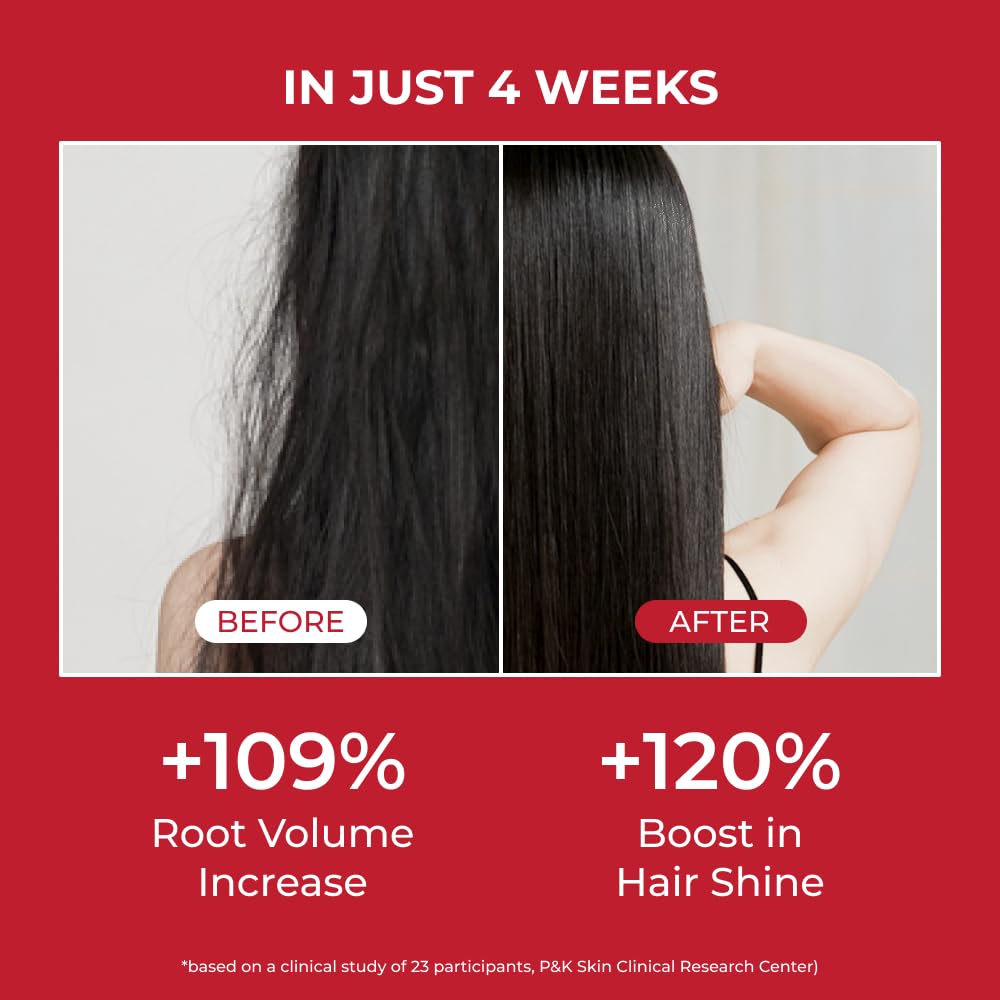 MOEV Annurcatin Shampoo 300ml