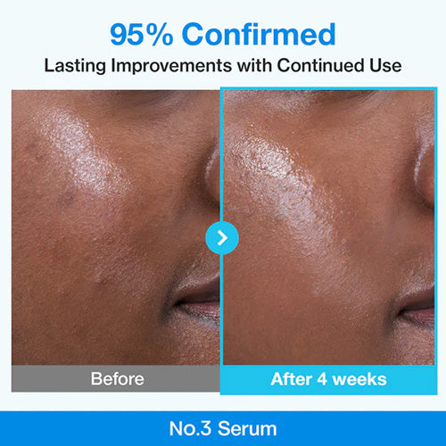 NUMBUZIN N0.3 Blue Bio-Retinol Pore Refining Serum 30ml