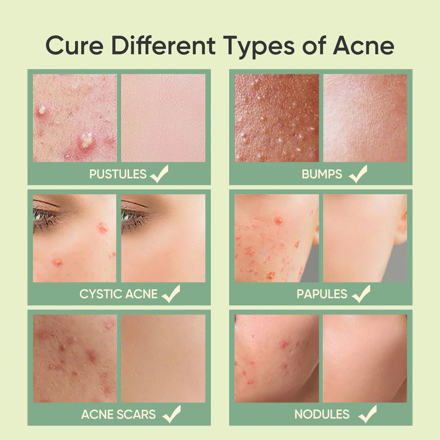 SKINTIFIC Salicylic Acid Acne Spot Gel