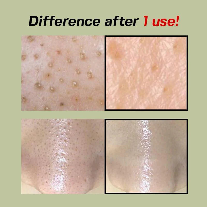SUNGBOON EDITOR Green Tomato Pore Peeling Jumbo Pad 180ml 60EA