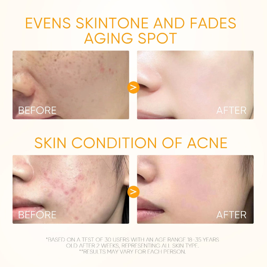 SKINTIFIC 10% Vitamin C Brightening Glow Serum