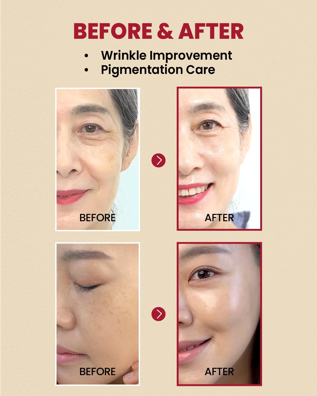 KSECRET 1988 Serum: Retinal Liposome 2% + Black Ginseng 30ml