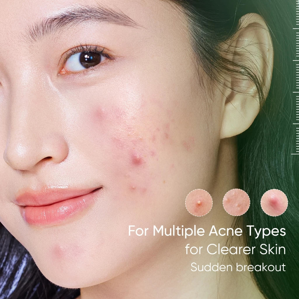 SKINTIFIC Acne Drying Lotion Kit