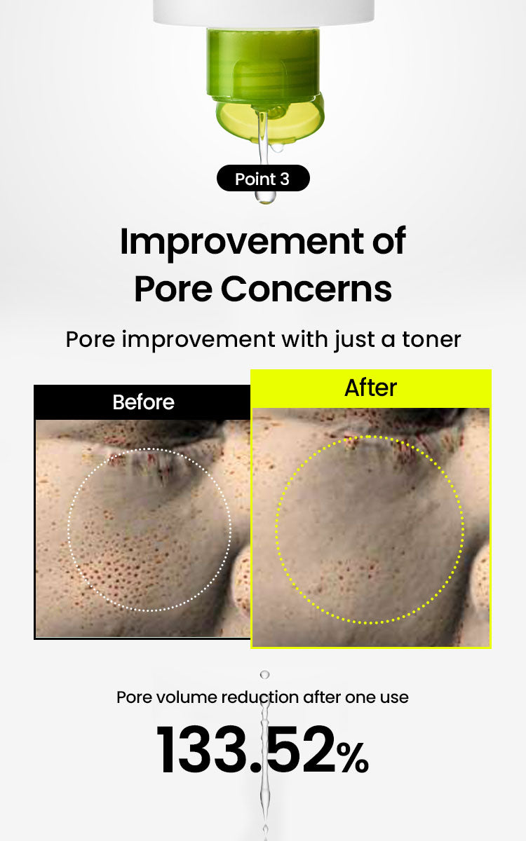 BEPLAIN MUNG Bean Pore Clearing LHA Toner 265ml