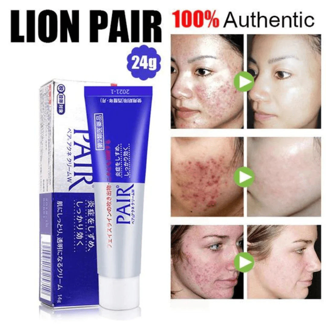 LION Pair Acne Cream 24g