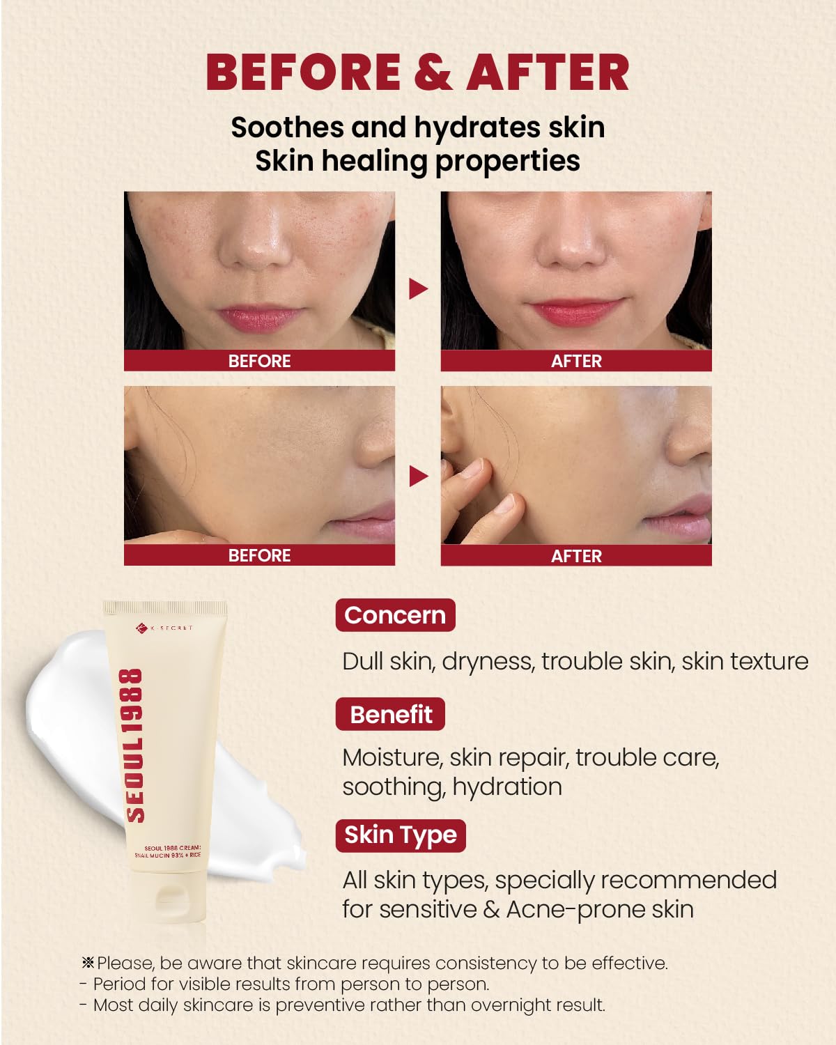 KSECRET Seoul 1988 Cream : Snail Mucin 93% + Rice 100ml