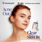VITAHEALTH SkinTru 30's