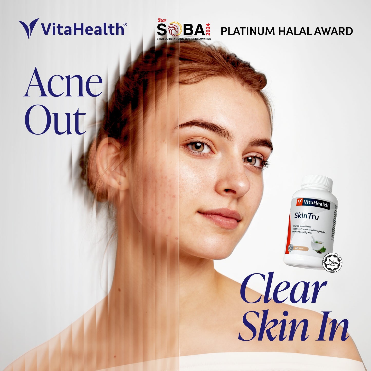 VITAHEALTH SkinTru 30's
