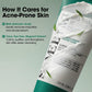 SOMEBYMI AHA BHA PHA 30 Days Miracle Acne Clear Foam