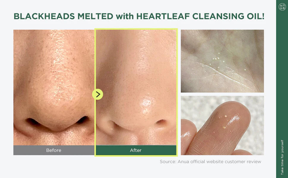 ANUA Heartleaf Pore Control Cleansing Oil 200ml (Buy 2 For $38.00)