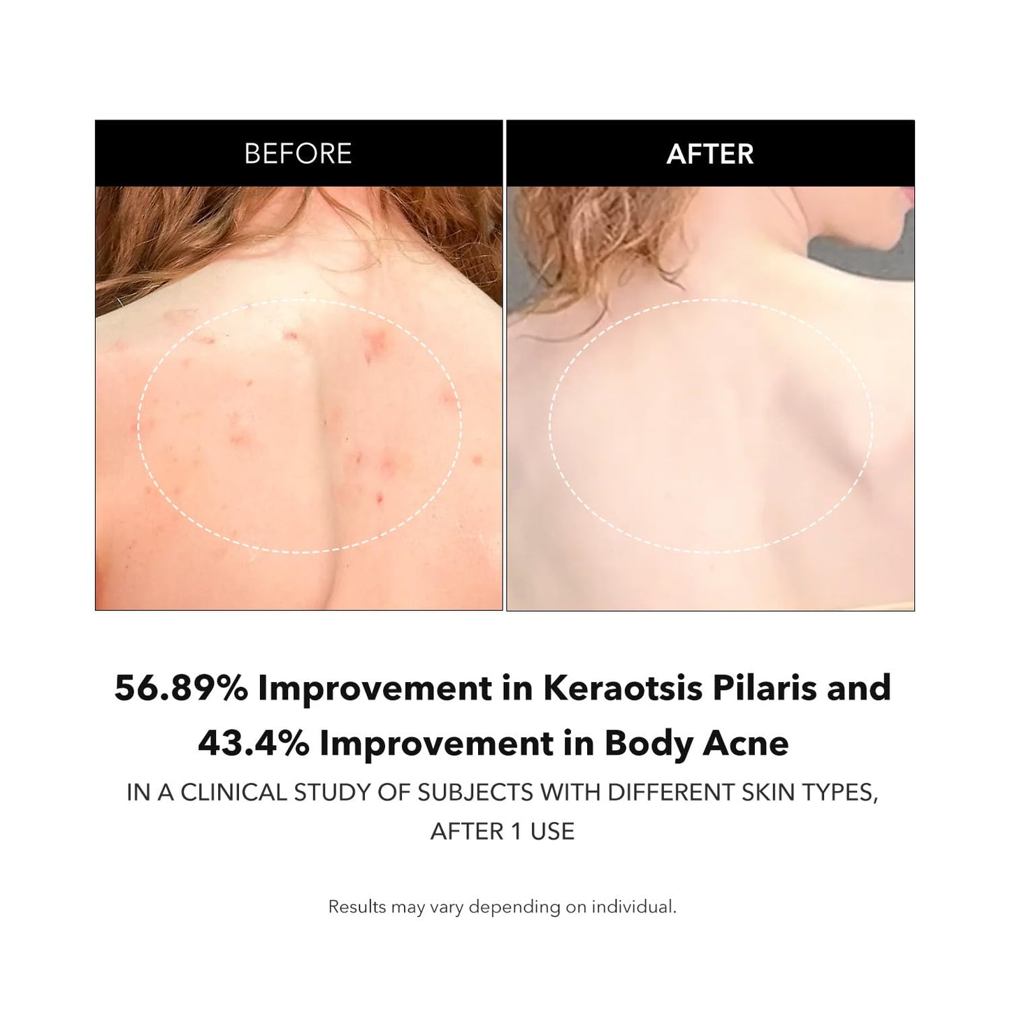 APRILSKIN Carrotene IPMP Exfoliating Body Wash 300ml