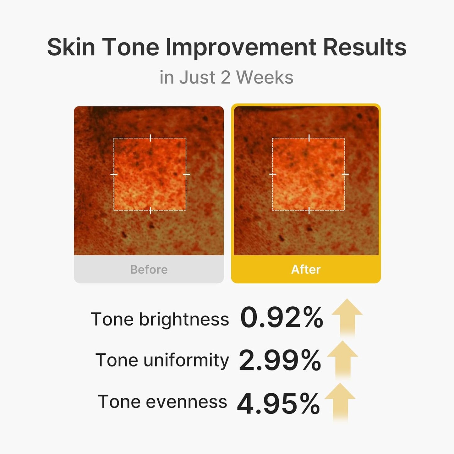 MEDICUBE Kojic Acid Turmeric Vita Capsule Cream