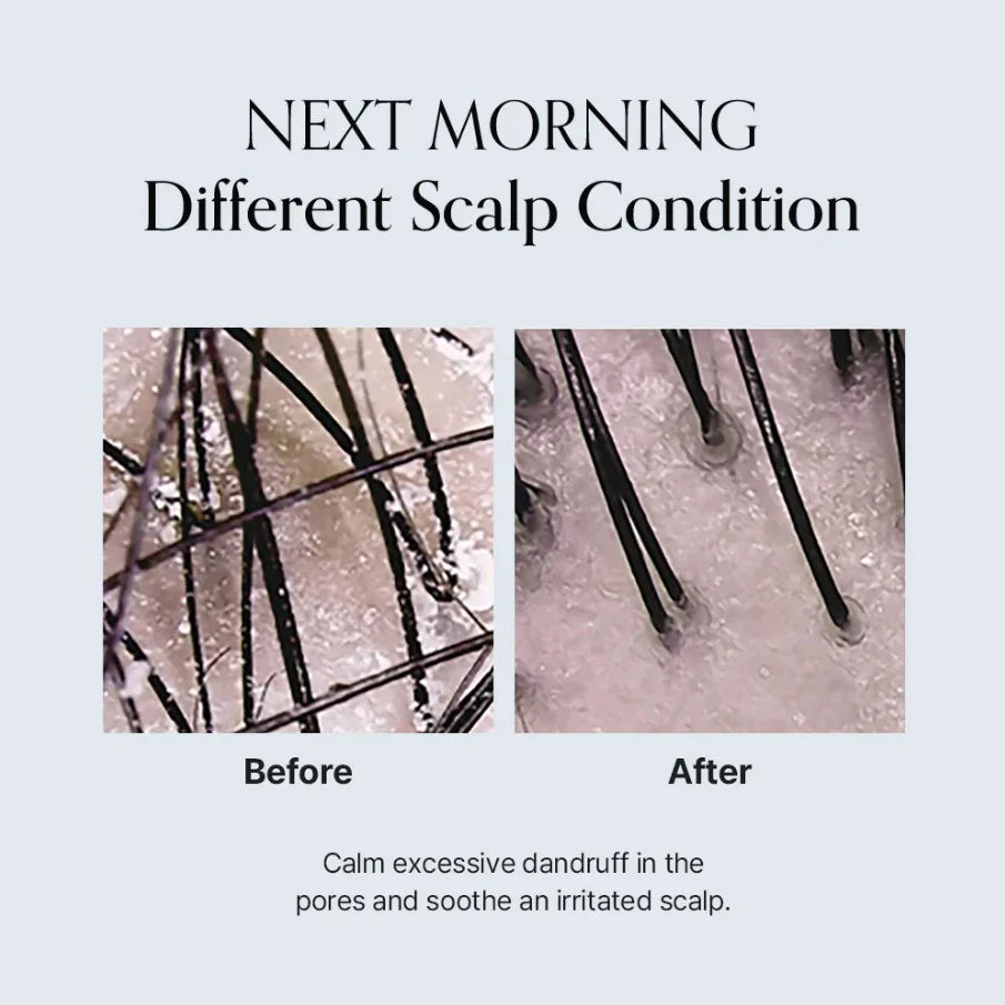 GROWUS Damage Therapy Scalp Scaling Ampoule 30ml