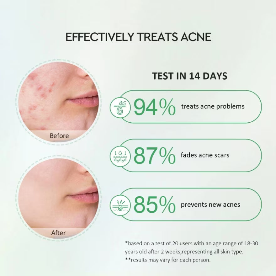 GLAD2GLOW Centella Salicylic Acid Power Acne Serum