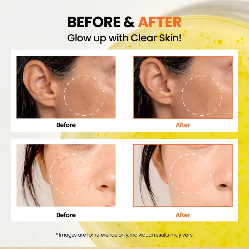 KSECRET Seoul 1988 Glow Serum : Niacinamide 15% + Yuja 30ml