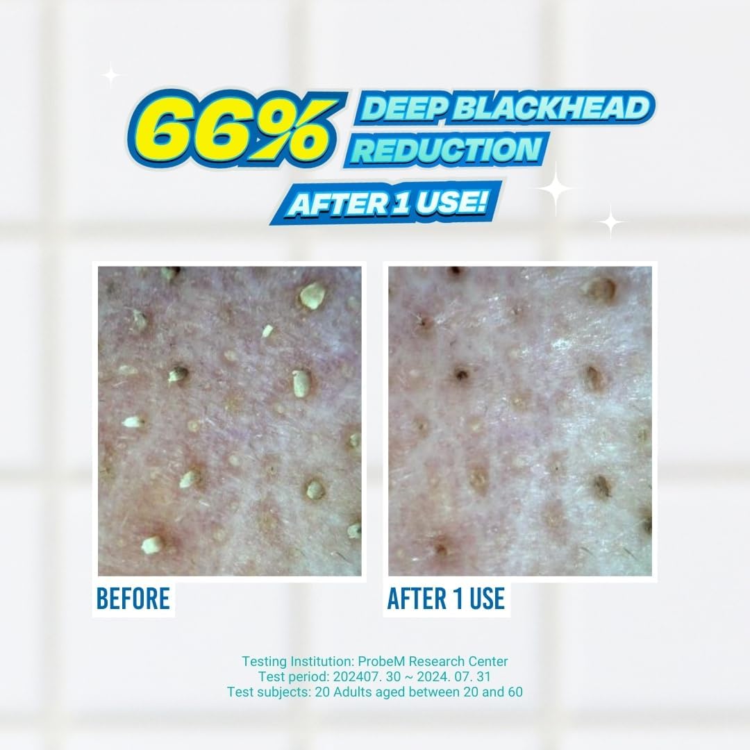 JUMISO Blackhead Melting Softener 150ml + Cotton Pad + Cotton Swab