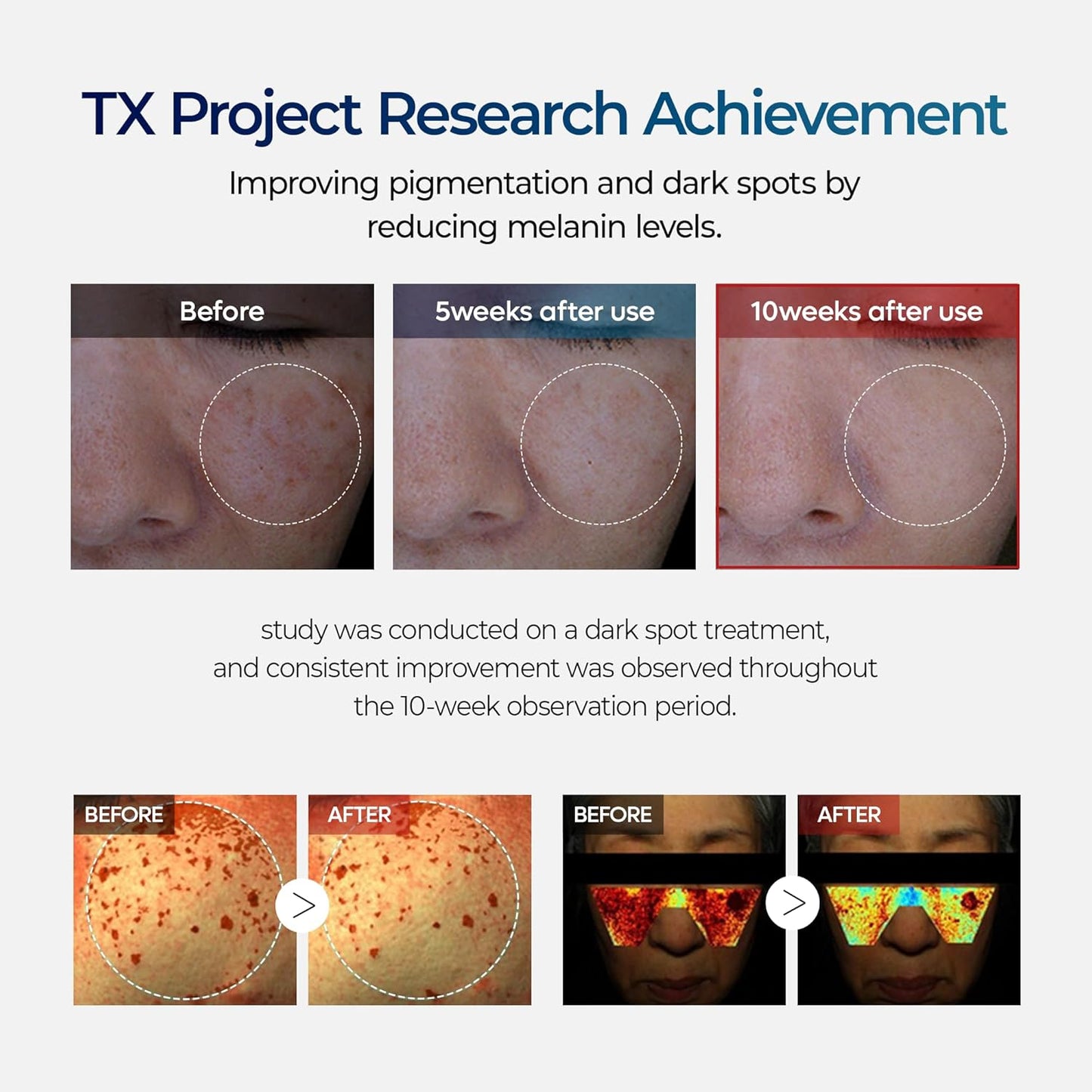 DR.MELAXIN TX Cream 50ml