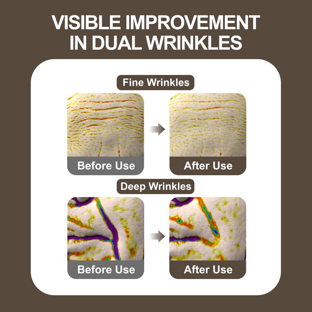 KOPHER Hynical 360 Lifting Cream 50ml