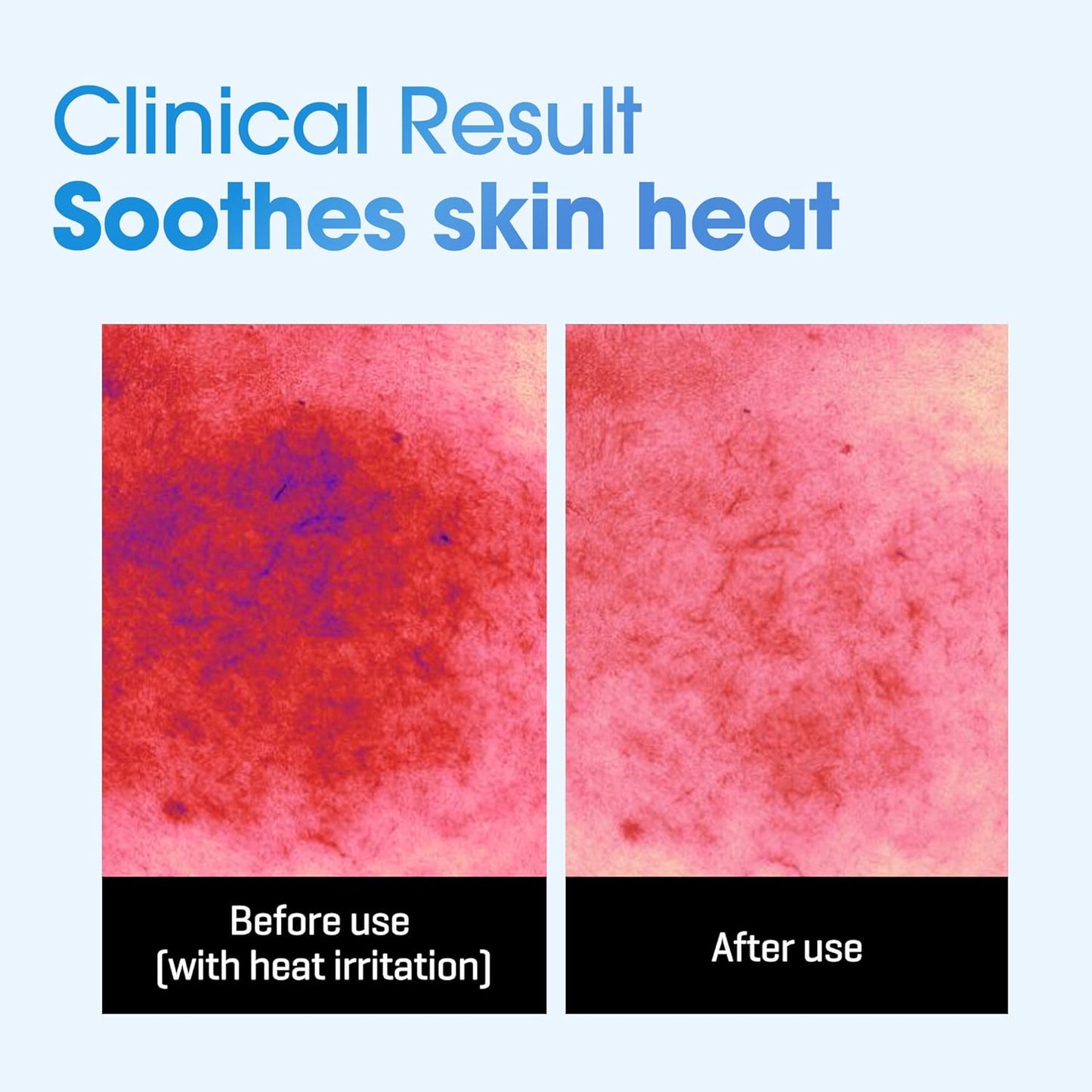 SOMEBYMI Beta Panthenol Repair Daily Mask 30EA