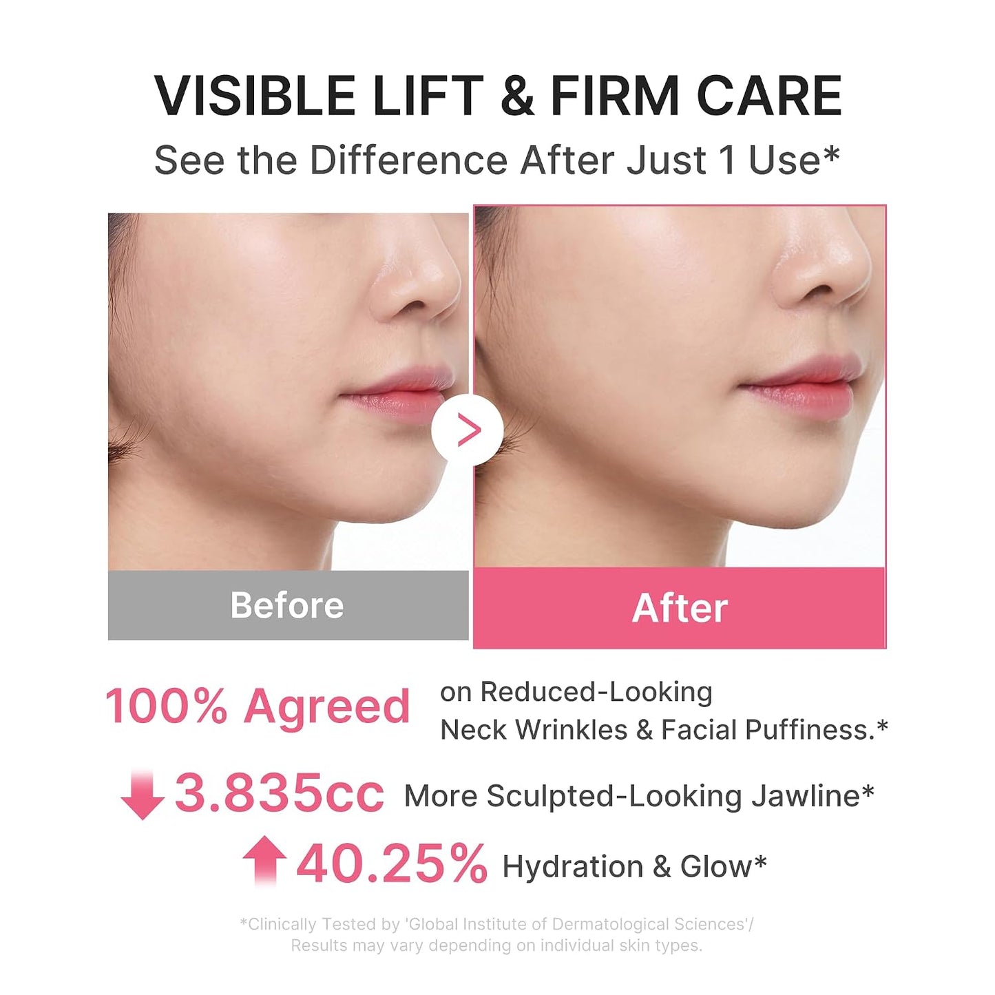 MEDICUBE PDRN Collagen Gua Sha Neck Wrinkle Cream