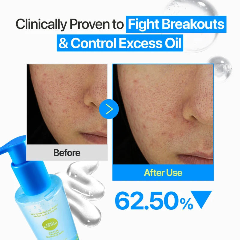 NUMBUZIN Zero Blemish Oil Free Micellar Cleansing Jelly 200ml
