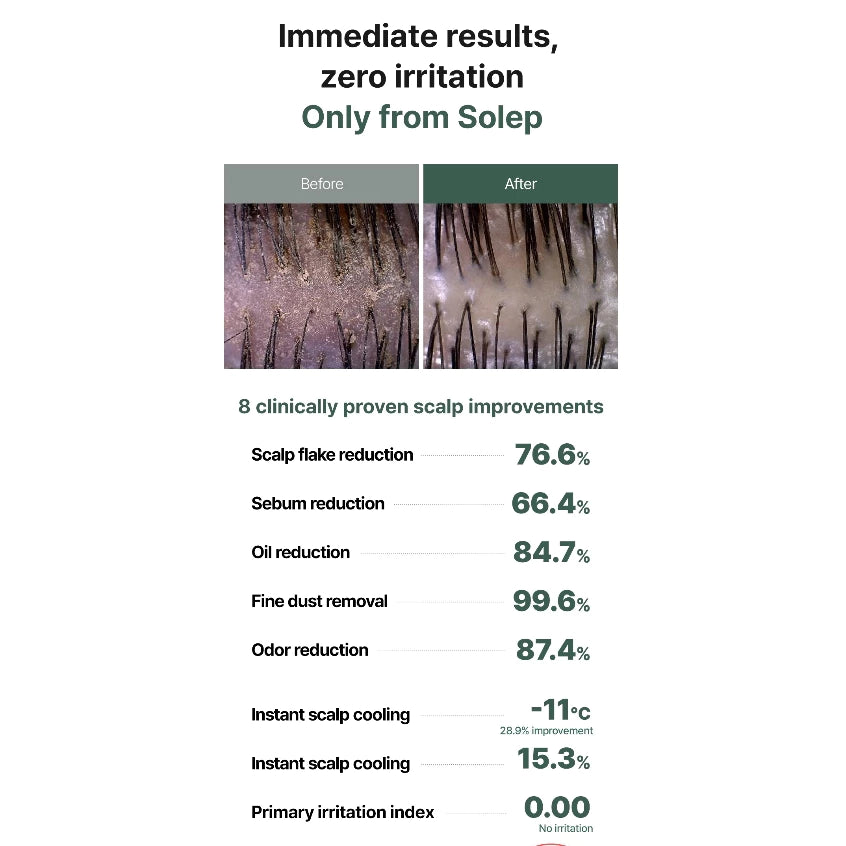 SOLEP Hair Root Aquapik Scalp Scaler 250ml