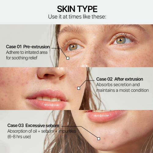 PARNELL Cicamanu Clear Patch 48ea