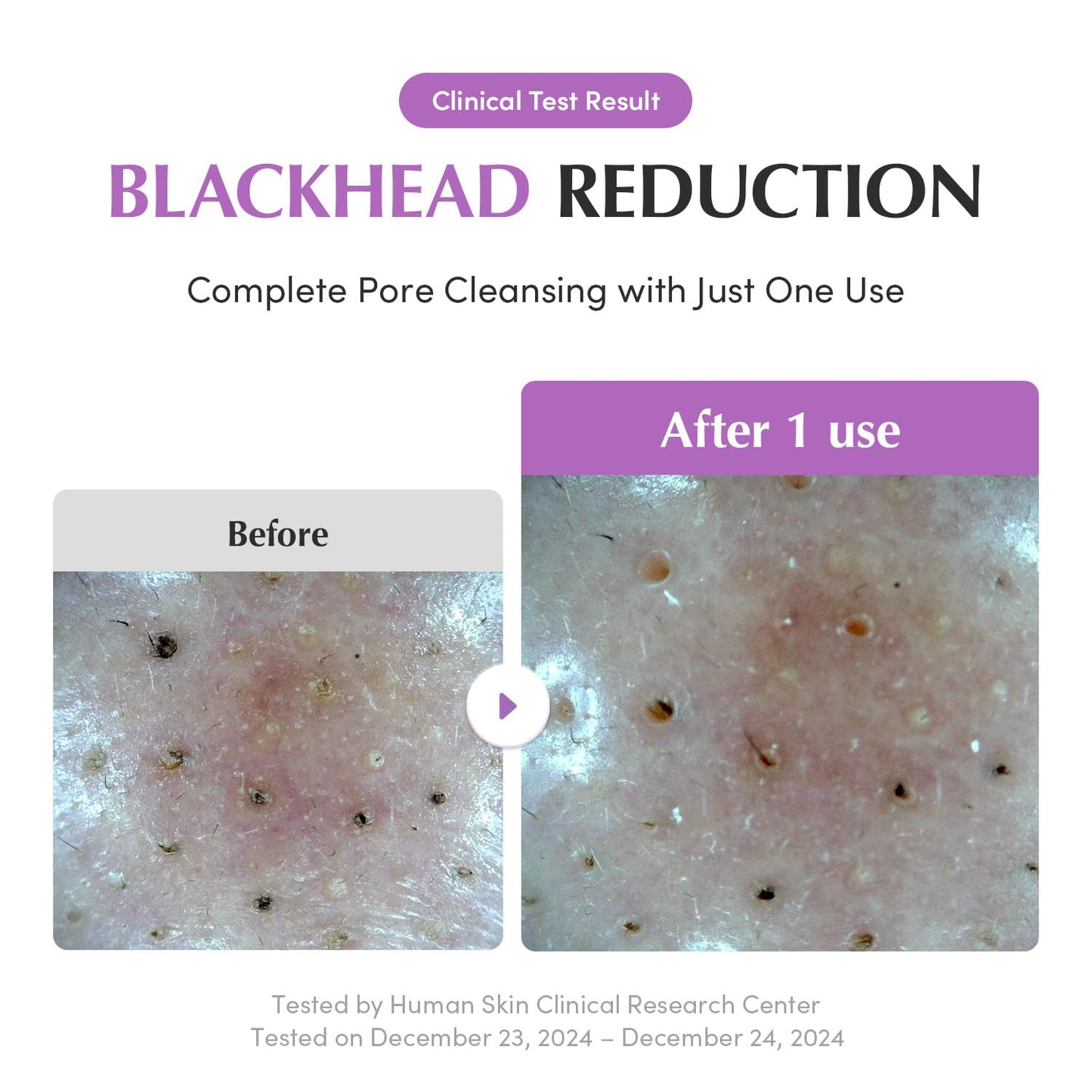 EQQUALBERRY Purple Rice Purifying Pack Cleanser 130g
