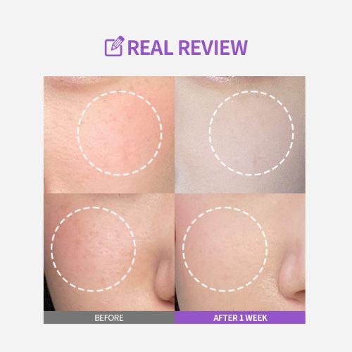 SUNGBOON EDITOR Meoru Podo Vita C Dark Spot Ampoule 30ml