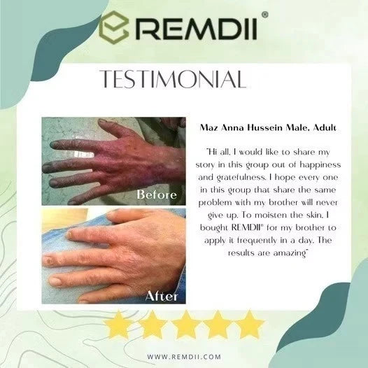 REMDII Sensitive Daily Intensive Moisturising Cream 28ml