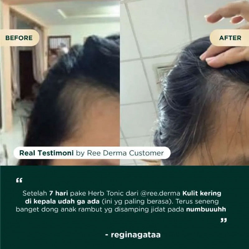 Ree Derma Herb Hair Tonic 250ml