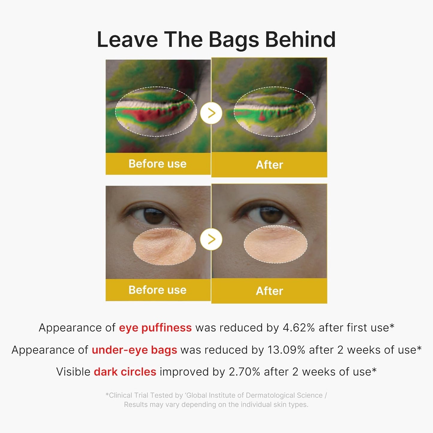 MEDICUBE Kojic Acid Turmeric Vita Eye Gel Serum 30ml