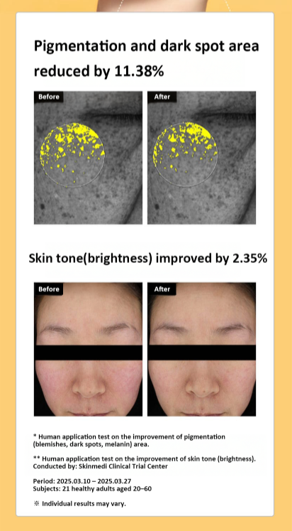 CELIMAX Pore + Dark Spot Brightening Serum Mask 1EA