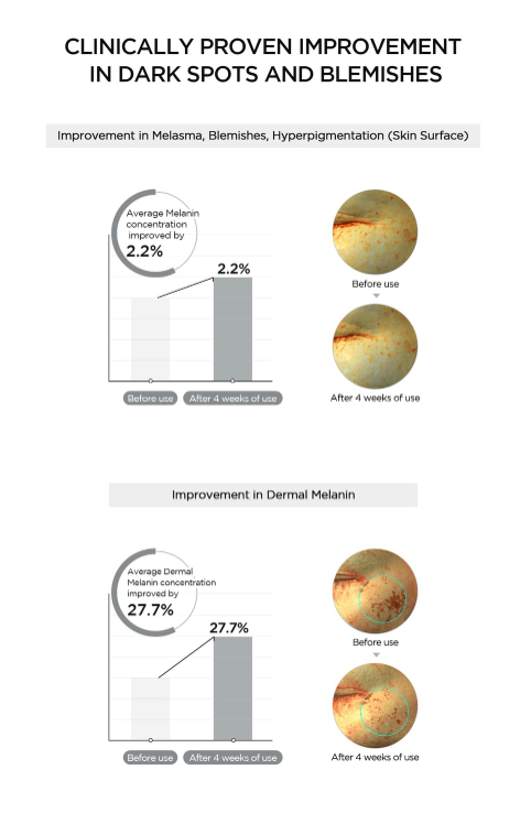 SKIN1004 Madagascar Centella Tone Brightening Dark Spot Ampoule Pad 60pads