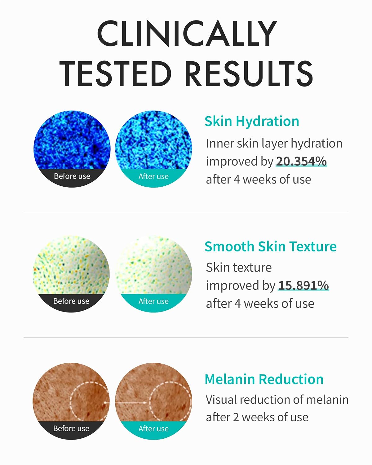 REJURAN Turnover Cream Enhanced 50ml