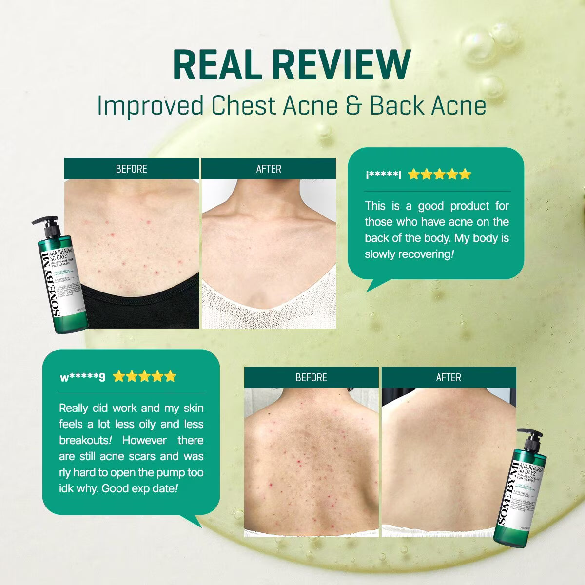 SOMEBYMI AHA BHA PHA 30Days Miracle Acne Clear Body Cleanser 400g