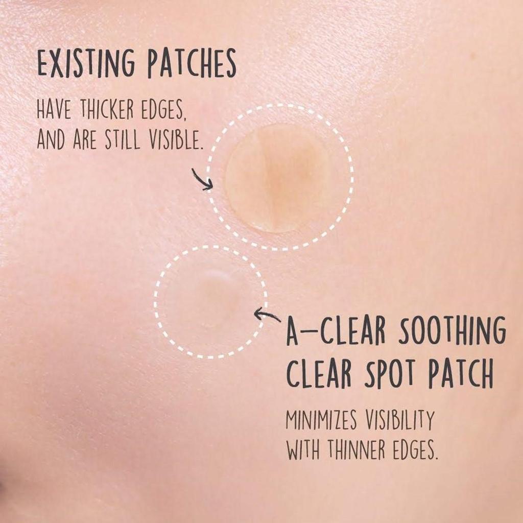 NEOGEN A-Clear Soothing Spot Patch