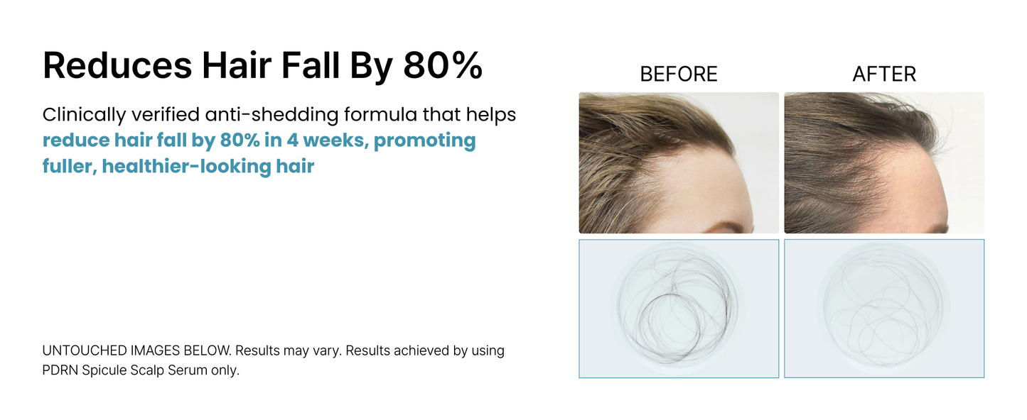 NESH PDRN Spicule Scalp Serum 50ml
