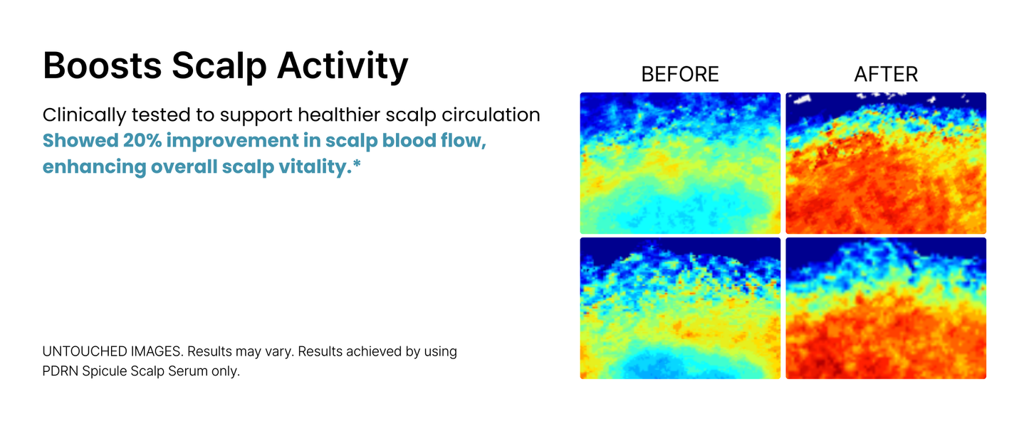 NESH PDRN Spicule Scalp Serum 50ml