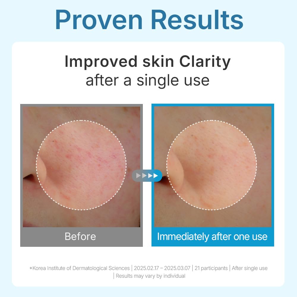 CENTELLIAN24 Hyal Waterfull Glow Gel Mask 1pc